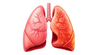 Breathe Easier: Limit These 7 Foods Now