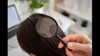 Frio e ar seco favorecem o aparecimento de caspa, diz dermatologista