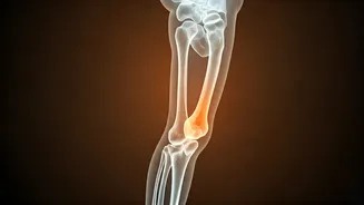 Beyond Weight: Unpacking the Hidden Bone Health Crisis in Childhood Obesity