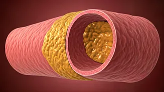 Heart Health: Understanding Plaques & Reversal Strategies