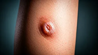 What Causes Skin Ulcers and How to Treat Them?
