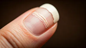 Why Are My Nails Peeling? Get Solutions Here.