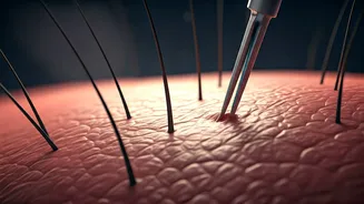 Hair Transplants: Unveiling the Astonishing, Rarely Discussed Complication