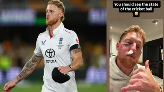 Watch : Ben Stokes suffers facial injury after being struck by a cricket ball