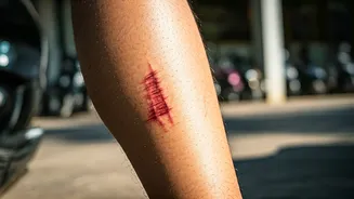 Beyond the Beach: Understanding the 'Thailand Tattoo' and Avoiding Scooter Scars