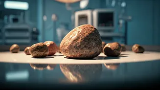 Kidney Stones: Symptoms, Causes, and Prevention Tips