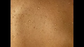Monsoon Skincare Tips for Indian Humidity