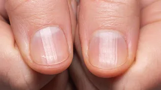 Fix fingernail ridges with these kitchen ingredients