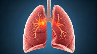 Cough Turning Dangerous? Spotting Pneumonia Early