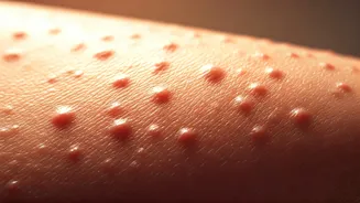 Beat the Heat Rash: Unmasking Summer Skin Irritation Myths & Solutions