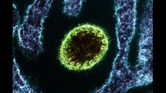 Kemenkes Pastikan Virus Nipah Belum Ditemukan di Indonesia