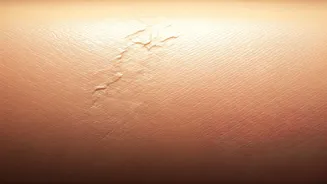Dermatologists Warn Against Ignoring Skin Barrier
