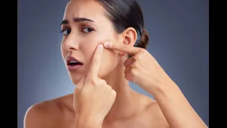 Struggling To Hide That Pimple On Your Face? This Is What It Means And How Can You Get Rid Of It