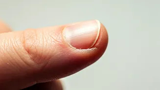 Unveiling the Causes & Solutions: Peeling Nails Explained