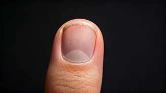 8 Nail-Biting Habits & The Shocking Ways They Harm You
