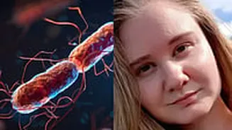 Russia plague scare: How is the world reacting?