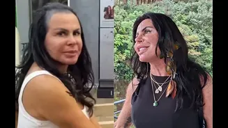Gretchen expõe drama com queda de cabelo e faz apelo às mulheres