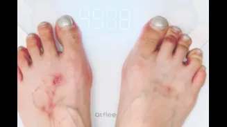 Could That ‘Weight Gain’ Be Something More? Why Women Shouldn’t Ignore Silent Gynaecological Changes