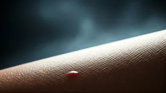 Monsoon Could Be Making Acne Harder To Control