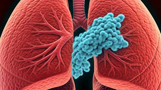 Aspergillosis in Urban India: Unmasking the Hidden Lung Fungus
