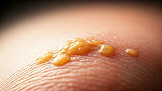 Eyelid Lumps: Your Heart's Silent Signal for Cholesterol Concerns