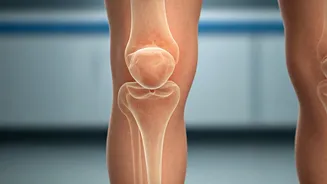 Beyond Bruises: Unmasking Hemophilia as the Hidden Cause of Childhood Joint Pain in India