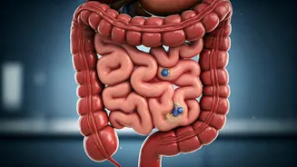 Don't Ignore Stomach Upset: Surgeon Warns of Silent Cancers with Devastating Consequences