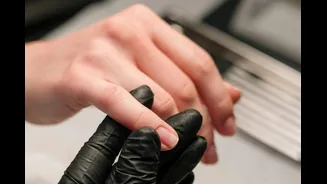 Nails Signalling Health Issues? Doctor Reveals 5 Changes In Your Nails You Shouldn’t Ignore