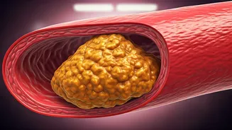 Heart Health: Understanding & Preventing Artery Plaque