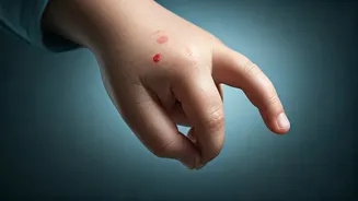 Children's Skin Woes on the Rise: Doctors Urge Parents to Spot Early Signs of Eczema, Rashes & Infections