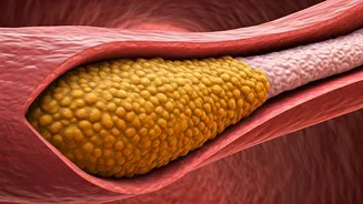 Decoding Artery Plaque: The Oral Health Connection