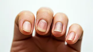 Nail Warnings: 6 Signs You Shouldn't Ignore!