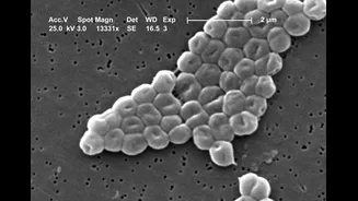 O que é acinetobacter? Superbactéria perigosa é encontrada em água de Porto Alegre