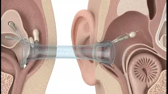 Mengenal Patulous Eustachian Tube (PET), Gangguan Telinga yang Membuat IU Menunda Aktivitasnya