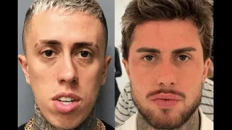 Botox e bioestimulador: entenda os procedimentos feitos por MC Daniel