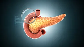 Beyond the Scroll: Unmasking Prediabetes with Science, Not Social Media Trends