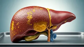 The Enigma of Toxic Coffee: A Jaundice Case Unveiled