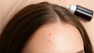 Forehead Breakouts? Unraveling the Mystery of Hair Oil and Acne