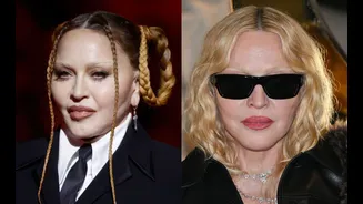 Antes e depois de Madonna chama atenção: quais procedimentos ela fez?