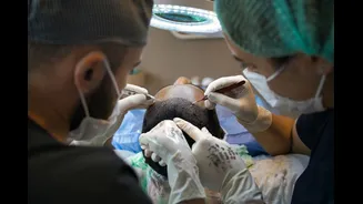 Médicos explicam diferenças entre transplante capilar e de barba