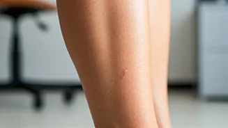 Sedentary Sorrows: Young Professionals Grapple with Rising Vein Issues