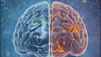 'Death switch' protein complex found in Alzheimer's patients