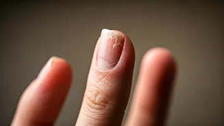 Unveiling Peeling Nails: Causes, Concerns & Care