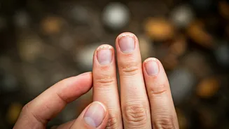 Unraveling Nail Peeling: Causes & Natural Solutions