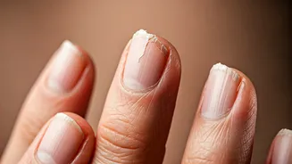 Unveiling the Mystery: Why Are Your Nails Brittle?