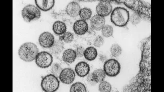 What Is Hantavirus? Why Cruise Ship Cases Are Raising Alarm