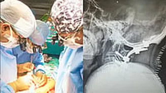 Mumbai: Man Walks Again After Rare Spine Surgery Ends 30 Years Of Pain And Disability