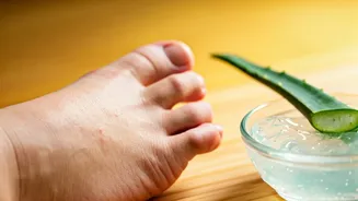 10 Quick Home Remedies to Soothe Shoe Bites