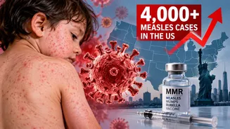 Measles outbreak in US, over 4,000 affected