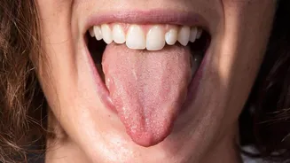 Fix tongue sensitivity with these kitchen hacks